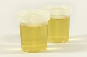 urine in a drug screen cup for testing