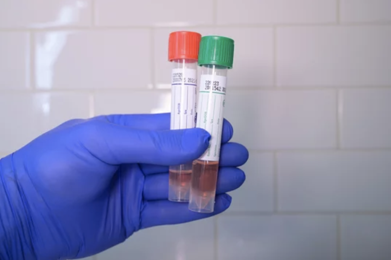 Phlebotomist holding two vials for medical testing specialty kit